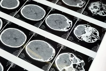 Imaging of the brain.
