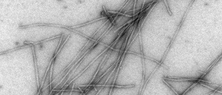 Amyloid-β (Aβ) fibrils, TEM