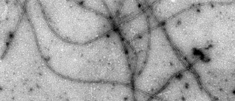 Amyloid-β (Aβ) fibrils, TEM