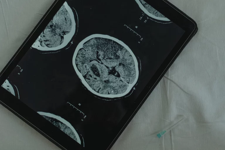 Imaging of the brain.