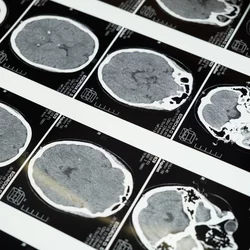 Imaging of the brain.