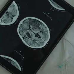 Imaging of the brain.