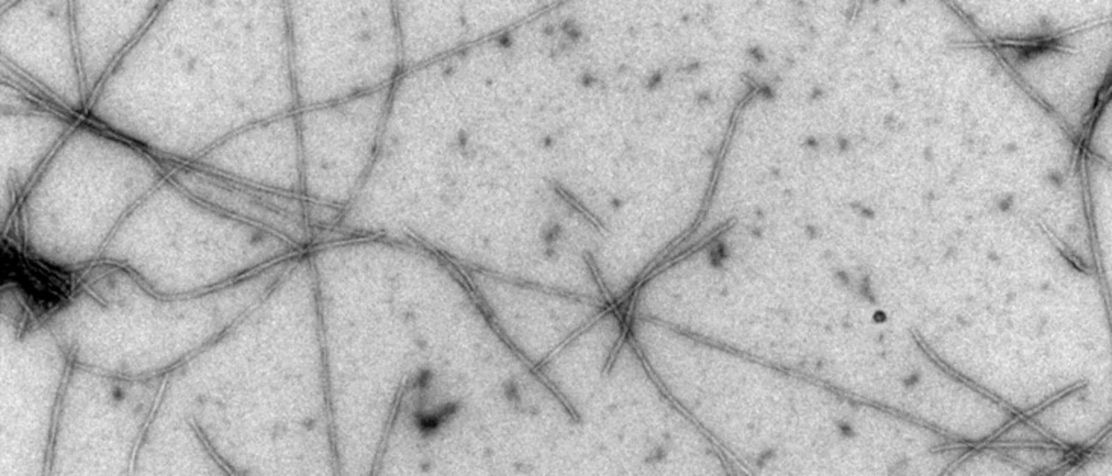 Amyloid-β (Aβ) fibrils, TEM