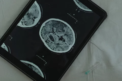 Imaging of the brain.